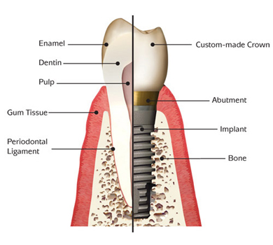 Implant Dentistry, Removable & Fixed Denture, Cosmetic Filling & Smile Design, Bleaching of Teeth, Correction of Mal Aligned Teeth, Root Canal Treatment, Single Sitting R.C.T, Treatment of Fracture of Jaw, MaxilloFacial Surgeries, Preventive & Pediatric Dentistry, Ultrasonic Scaling & Gum Surgery, Dental X-Ray, Dentist in Ludhiana, dentistry, punjabi doctor, dental doctor, dental specialist, dental surgeon, cosmetic dentistry, Ludhiana, dentistry, restorative dentistry, hi tech dentistry, teeth whitening, gold restorations, bonded porcelain, comfortable dentistry, ultrasonic dental instruments,  Computerized Dentistry, General Dentistry, Dentist In Ludhiana / Punjab, Implant Dentist In Ludhiana / Punjab, Dental Clinic In Ludhiana / Punjab, Dentist, Dentist In Ludhiana, Tooth Dentist, Implant Dentist, Dentist Clinic, Dental, Dr Dental, Dental Clinic, Dental Dentist, In Ludhiana, Punjab, India, Dentist, Dentist In Ludhiana, Tooth Dentist, Implant Dentist, Dentist Clinic, Dental, Dr Dental, Dental Clinic, Dental Dentist, In Ludhiana, Punjab, India.